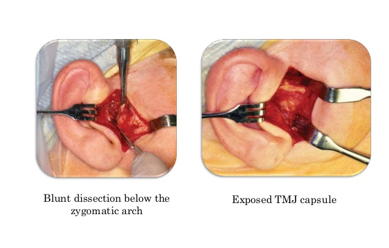 <p>SENN RETRACTOR (cat paw retractor)</p>