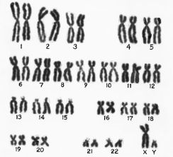 <p>Karyogram</p>