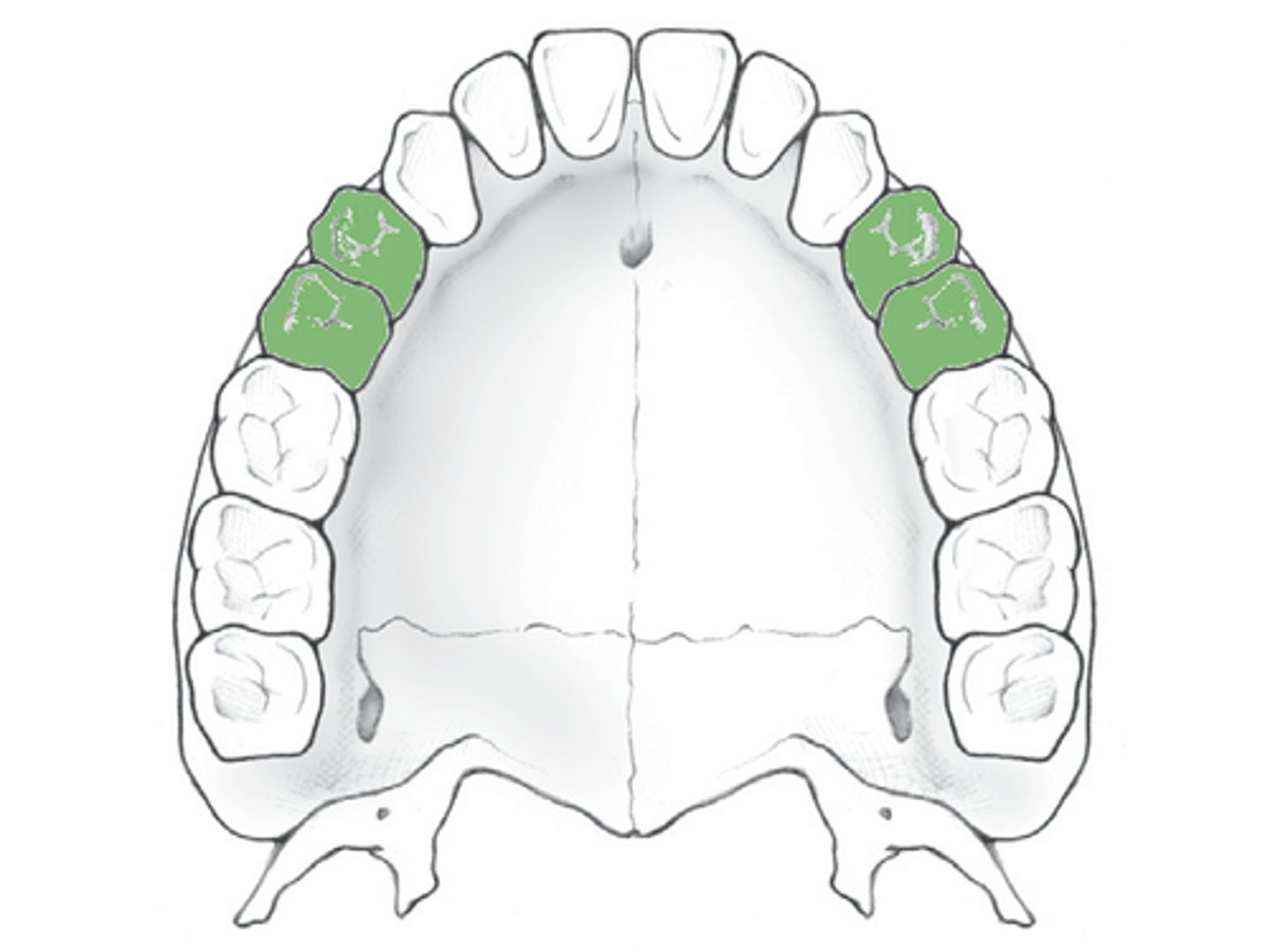 <p>bicuspid</p>