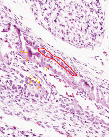 <p>Foetal head, coronal section, haematoxylin and eosin</p>
