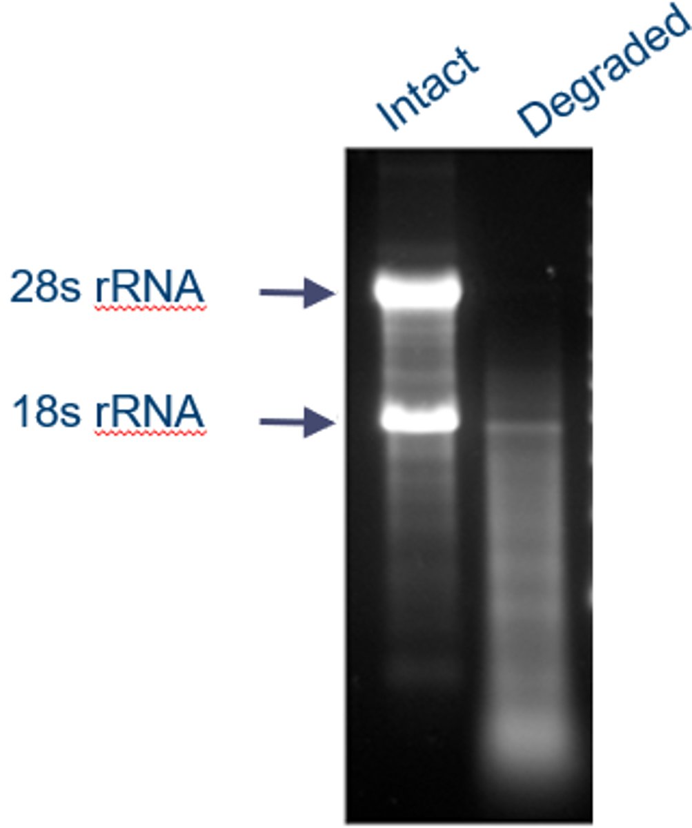 <p>-within cells, tRNA and rRNA are stable</p><p>-mRNA is unstable because:</p><p>~OH- attacks the extra O on ribose</p><p>ribonucleases enzymes attack mRNA and break it down</p><p>~as seen on northern blotting: (the degraded RNA is in the presence of RNAase)</p><p>-when an RNA is degraded, there is a gradient of the fluorescent probe, no strong bands of any sort and no clear readings off the Northern Blot can be made</p><p>-when an RNA is intact, very strong and clear bands of the probe can be seen</p><p>-RNA degradation is useful because it allows us to get rid of defective mRNA and not make defective proteins. It is not bad for the cell because there are a lot of mRNAs that get produced so degradation of some does not affect overall performance. Also, mRNA is constantly being made as genes are always being transcribed so it's degradation allows for mRNA not to be oversaturated.</p>