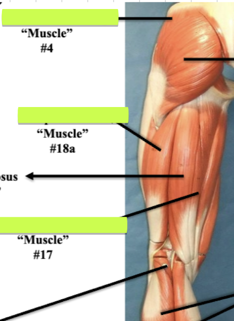 <p>Label muscle #18a </p>