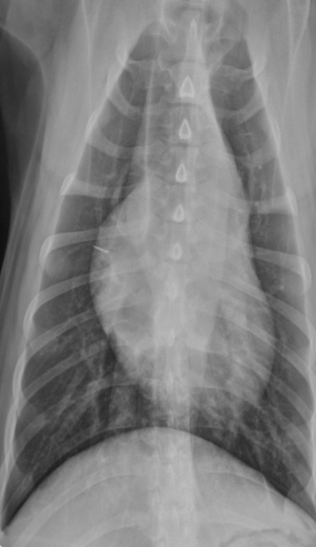 <p>What part of the heart is enlarged?</p>