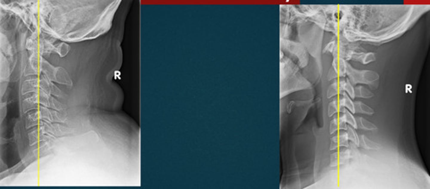 <p>What line of mensuration is this?</p>