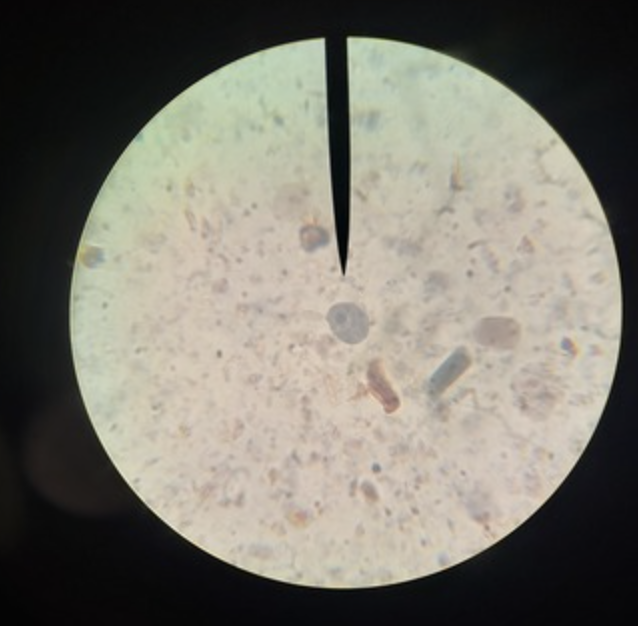 <ul><li><p>identify</p></li><li><p>m.o.t</p></li><li><p>infective stage</p></li><li><p>host</p></li></ul><p></p>