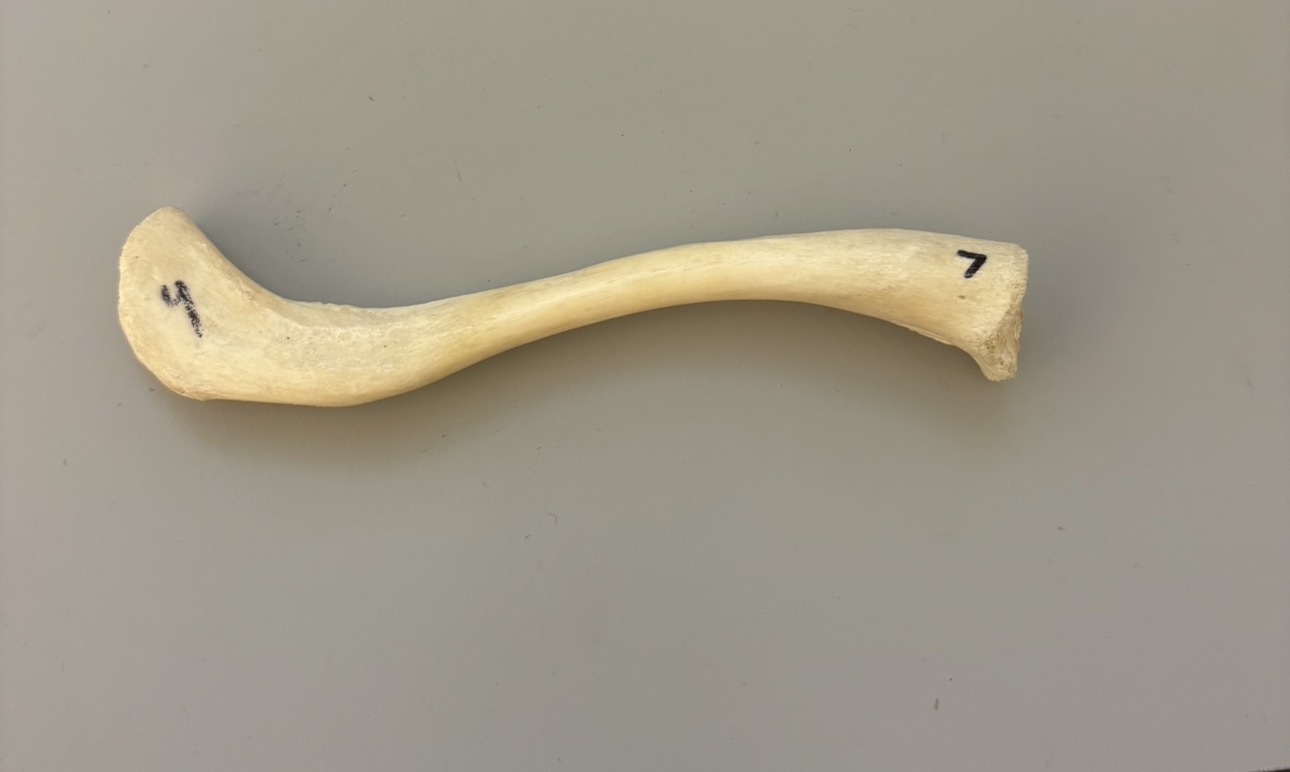 <p>What bone is this?</p>