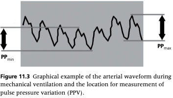 <ul><li><p><span>Pulse pressure variation (PPV) can be used to evaluate the need for fluid volume in patients undergoing mechanical ventilation</span></p><ul><li><p><span>Calculated value is based on the difference between systolic and diastolic arterial pressure during the inspiratory and expiratory phases of positive pressure ventilation</span></p></li></ul></li></ul><p></p>
