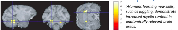 <ul><li><p>Changes in <strong>number + quality of contact</strong> between neurons (synapses)</p></li><li><p>Change in <strong>myelination</strong> (ability to make <mark data-color="yellow">new oligodendrocytes</mark> + <mark data-color="yellow">myelin</mark> important for learning) </p></li></ul>
