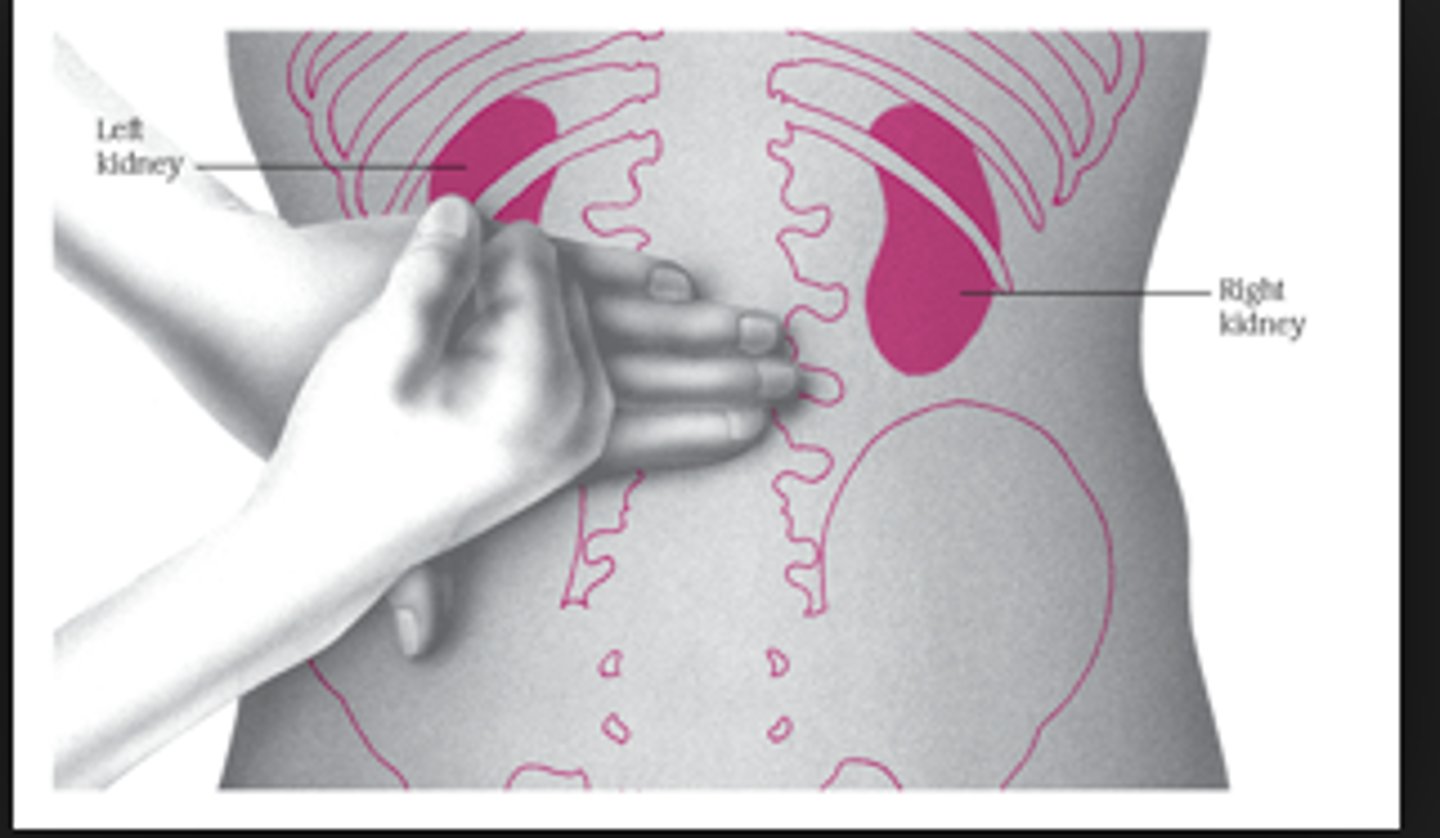 <p>costovertebral angle tenderness</p>