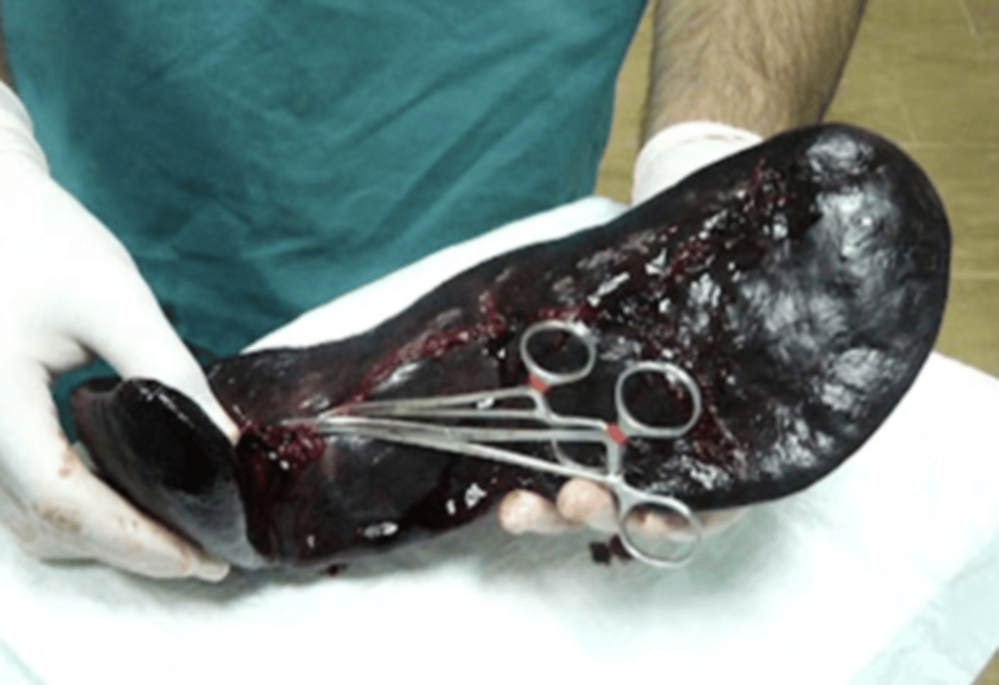 <p>what is the name for this operation?</p>