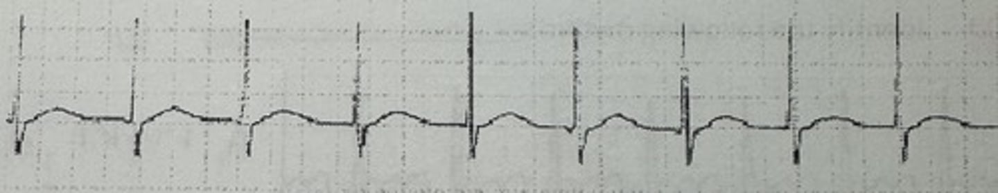 <p>identify the rhythm</p>