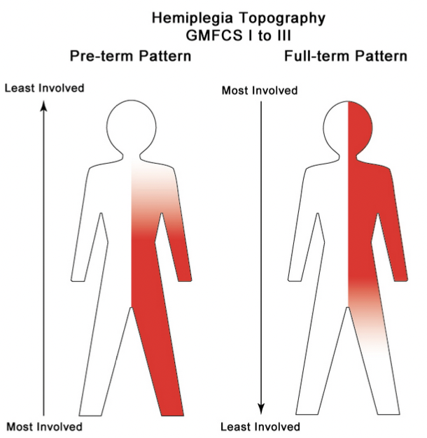 <p>stiffness and weakness on one side, awkward and jerky gait </p>