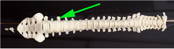 <p>What process is indicated by the green arrow?</p>