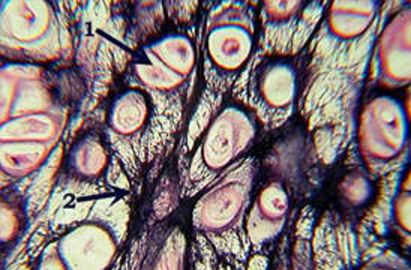 <p>- To identify: has lacunae and dark-staining elastin fibers</p><p>- More flexible than hyaline cartilage</p><p>- Found in auricular of ear and epiglottis</p>