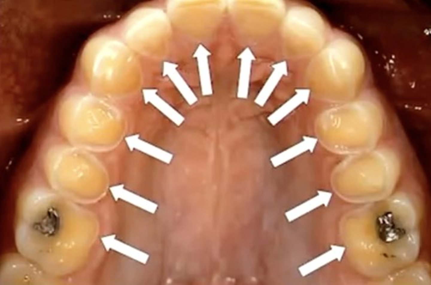 <p>this is a clinical presentation of</p>