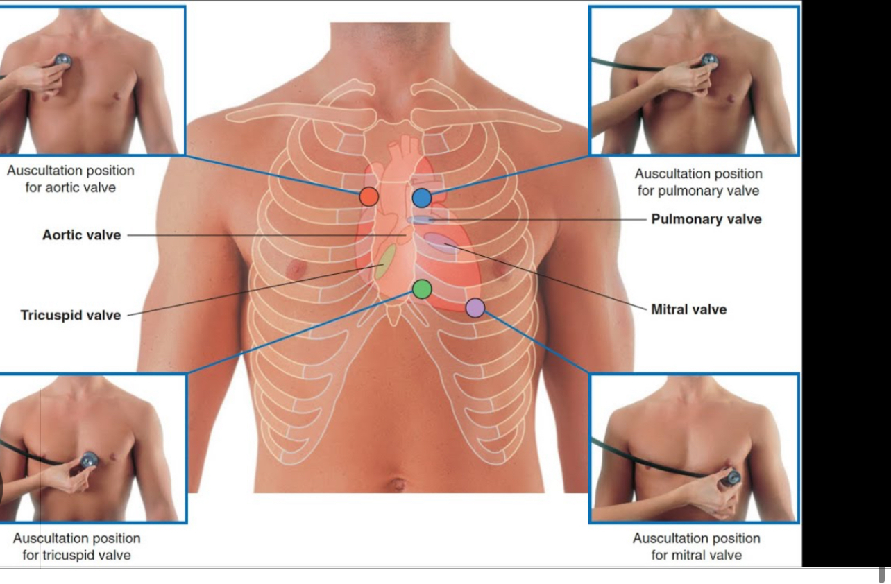 <p>Pulmonary - Left 2nd ICS</p><p>Aortic - Right 2nd ICS</p><p>Mitral Stenosis - Apex of Heart (5th ICS mid claviculr line (MR - apex same but radiates to axialla</p><p>Triscuspid - 4-5th ICS left sternum border</p>
