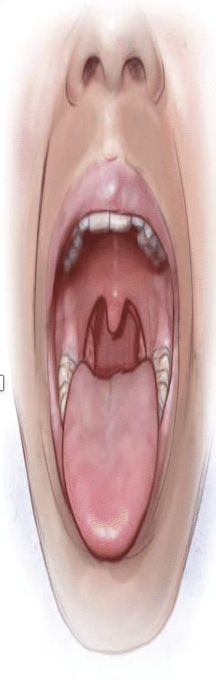 <p>Mallampati 1 score </p>