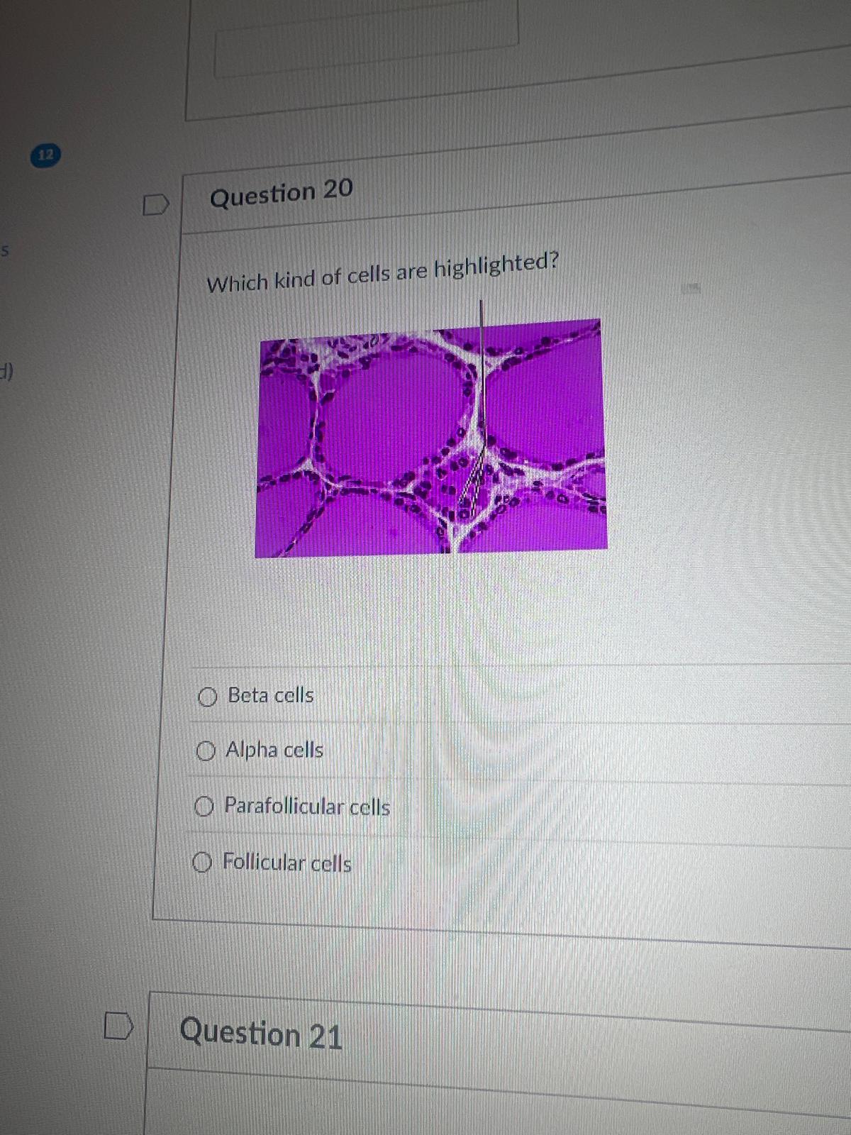 <p><span>Which kind of cells are highlighted?</span></p><p><span>Beta cells</span></p><p><span>Alpha cells</span></p><p><span>Parafollicular cells</span></p><p><span>Follicular cells</span></p>