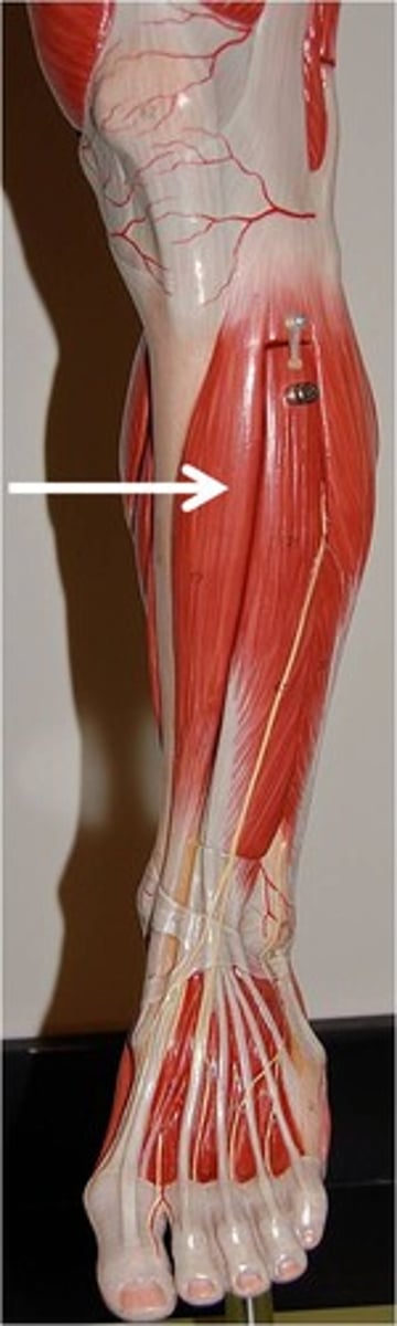 <p>dorsiflexes and inverts foot</p>