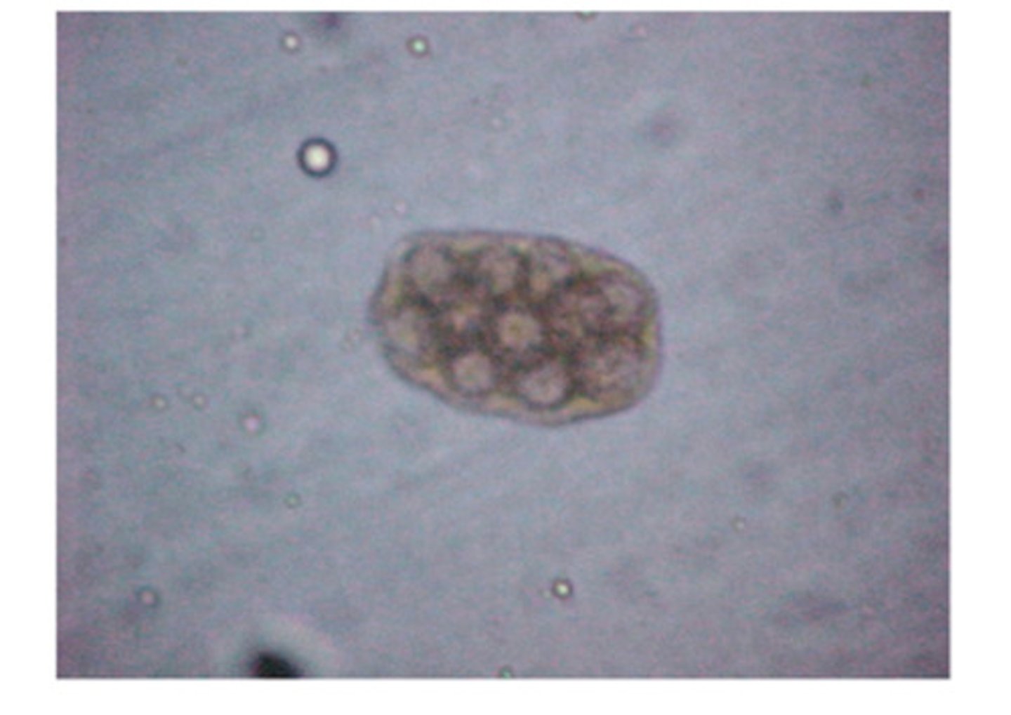 <p>If you find this egg packet on fecal flotation, you can positively ID it as..</p>