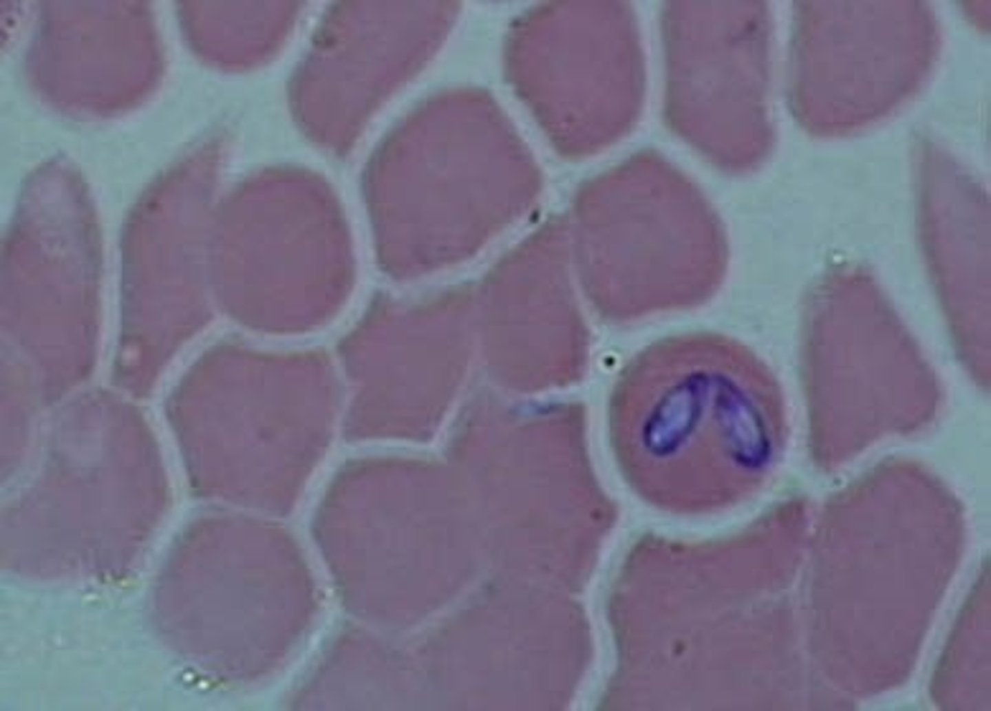 <p>- Transmitted by ticks</p><p>- Forms trophozoite, similar to malaria</p>