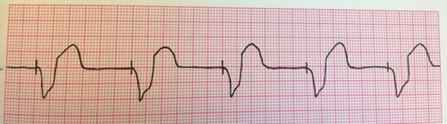 <p>What kind of pacemaker is this?</p>