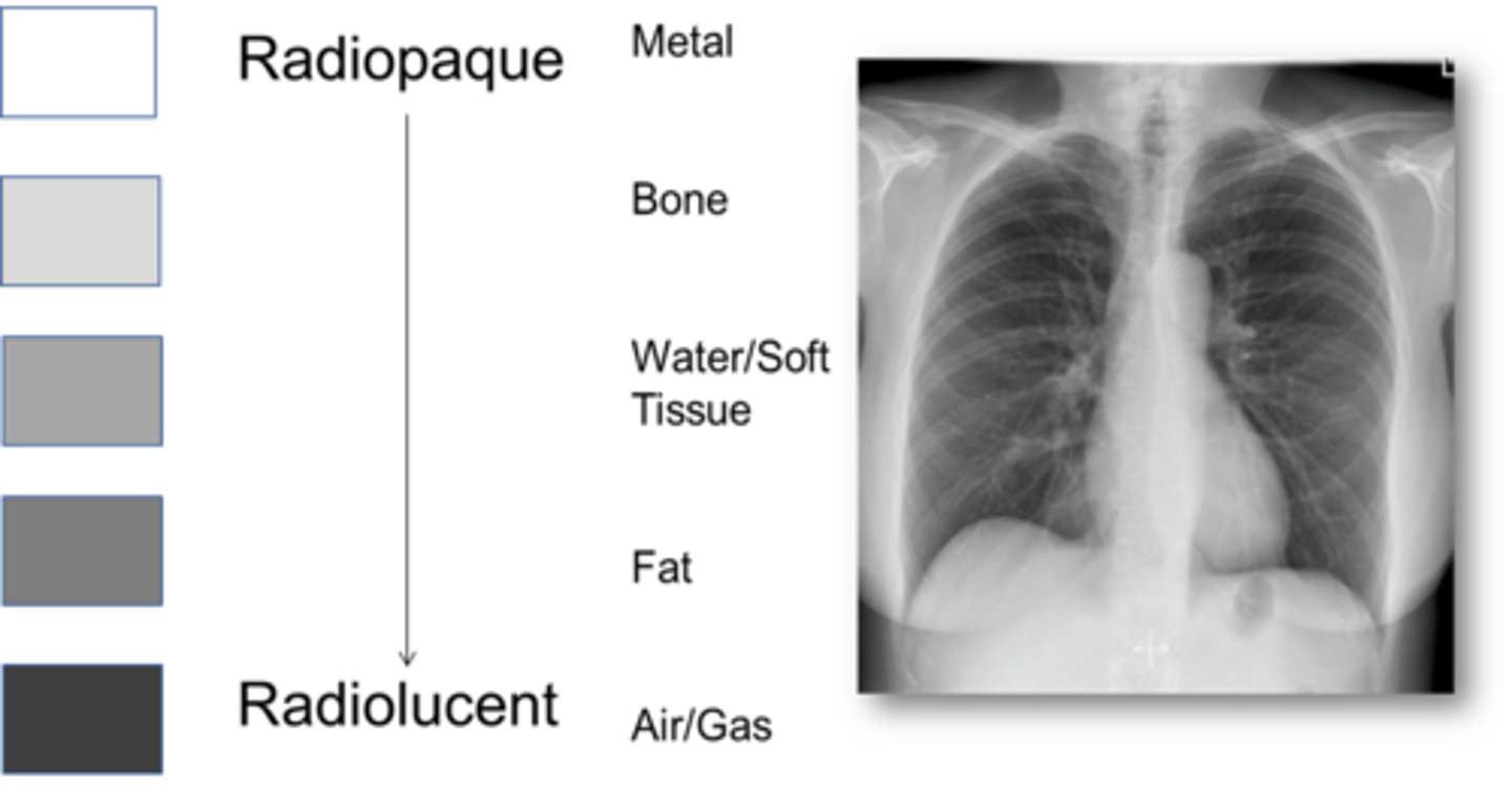 <p>anatomy is filled or outlined by NEGATIVE contrast agent; appears DARK on the radiography</p>