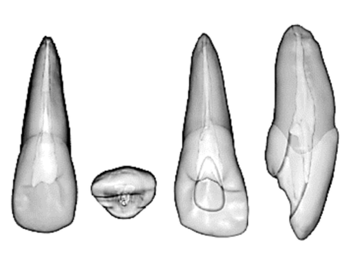 <p>maxillary lateral incisor</p>