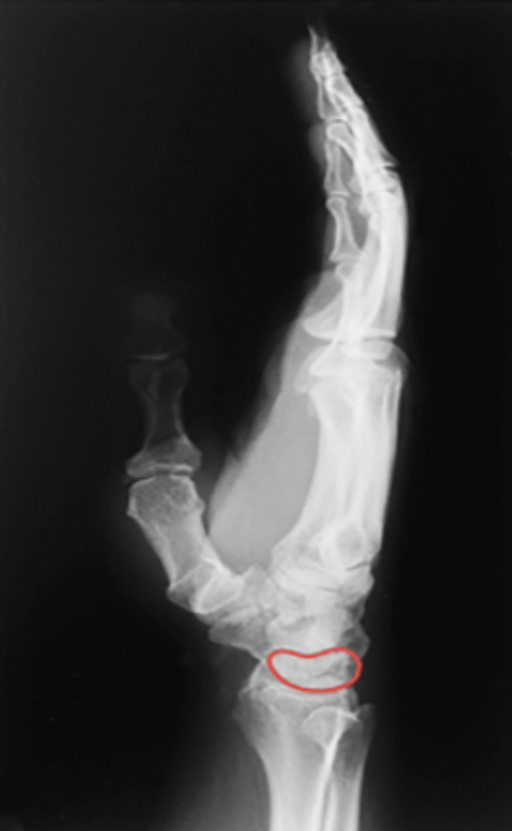 <p>What structure is highlighted?</p>