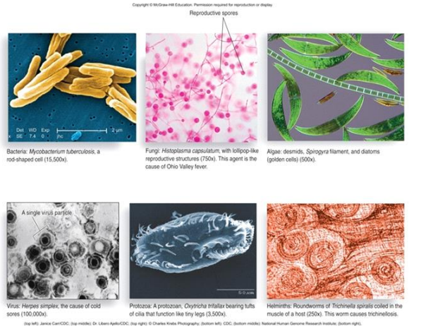 <p>bacteria</p><p>fungi</p><p>algea</p><p>virus</p><p>protozoa</p><p>helminths </p>