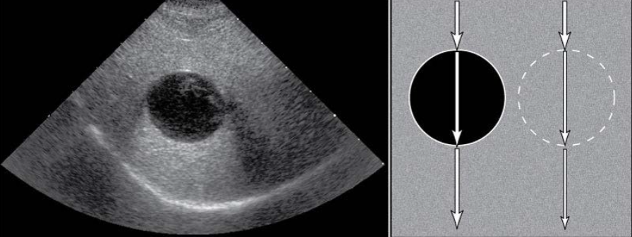 <p>Acoustic Enhancement</p>