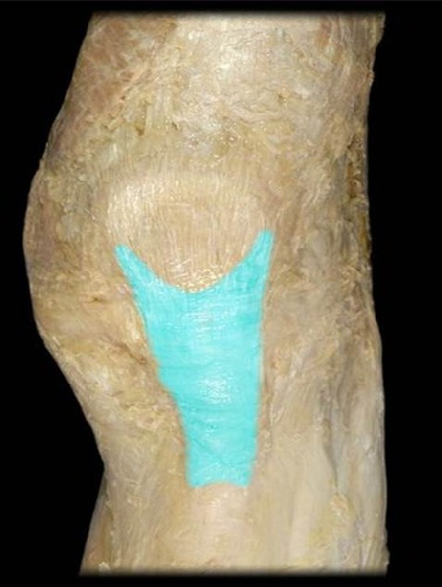 <p>Identify this connective tissue structure.</p>