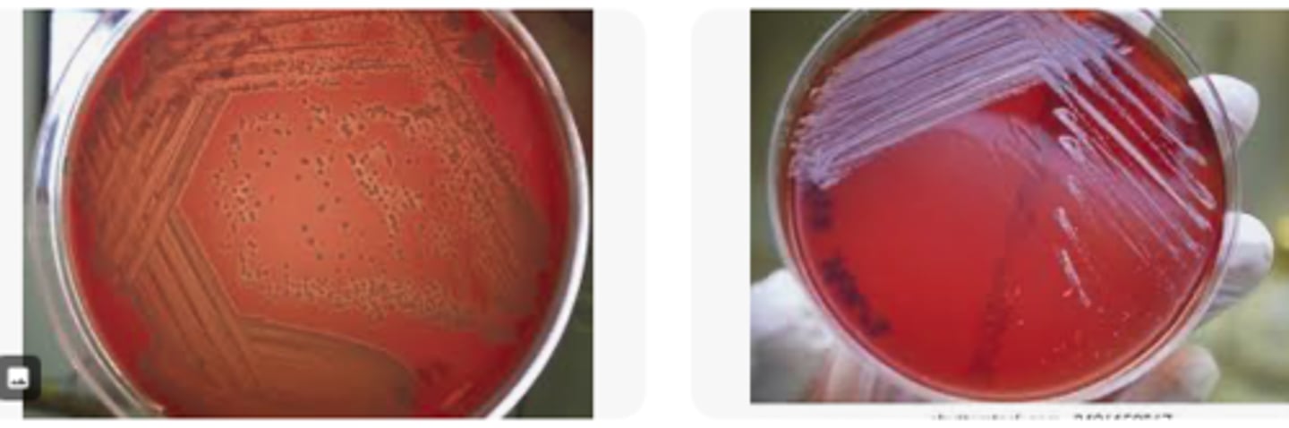 <p>This organism was isolated from aspirates collected from several enlarged superficial lymph nodes from a number of sheep in a flock. You have been given a 48 hr BA</p><p>culture. There was no growth on MacConkey agar. A Gram-stained smear from the lymph node aspirates showed intracellular and extracellular small gram-positive bacilli and coccobacilli; coryneform morphology was observed.</p><p>Examine bacterial colonies and describe. Is hemolysis present?</p>