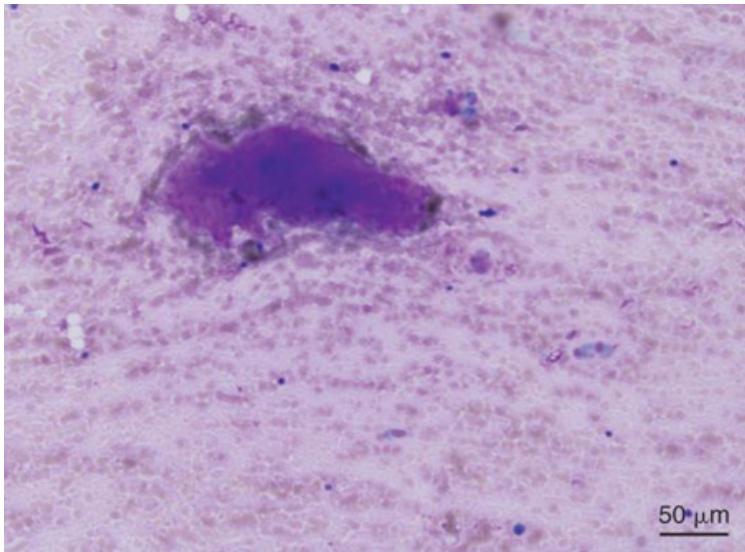 term image