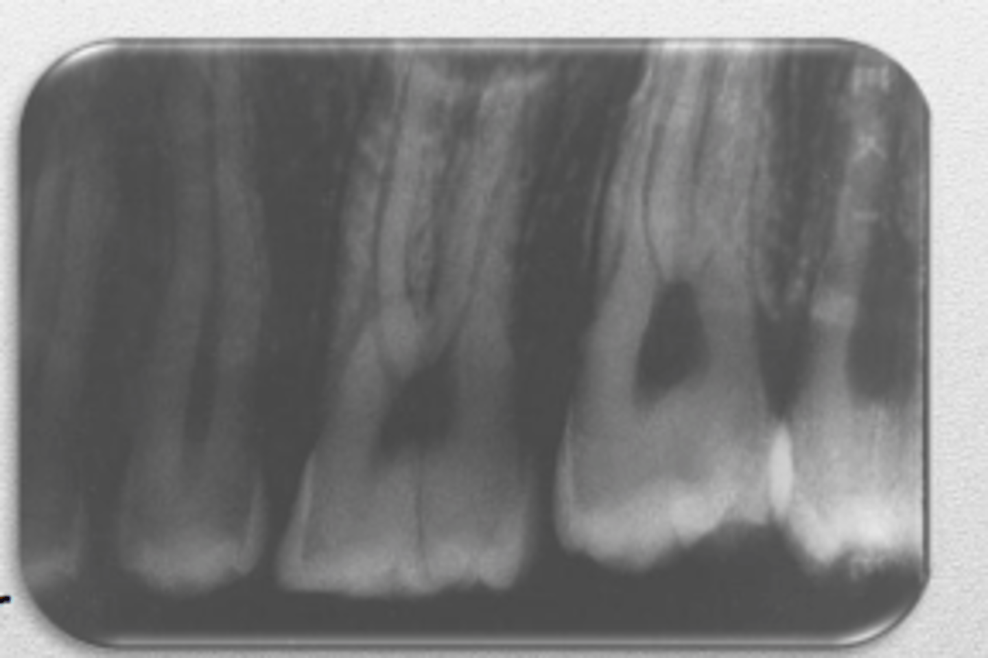 <p>film too dark</p>