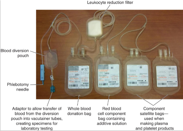 <ul><li><p><span><span>Whole blood collected from donor into plastic collection bag containing anticoagulant preservative</span></span></p><ul><li><p><span><span>Satellite bags are storage containers for blood components prepared from donation</span></span></p><ul><li><p><span><span>e.g. plasma, platelets</span></span></p></li></ul></li></ul></li><li><p><span><span>The closed system ensures no foreign contaminants from the outside environment can enter system</span></span></p></li></ul><p></p>