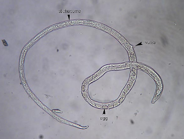<p><span><span>What is the genus, species, and stage of this parasite?</span></span></p><p>• Embedded in intestinal mucosa</p><p>• Long stichosome esophagus</p><p>• Eggs in uterus</p>