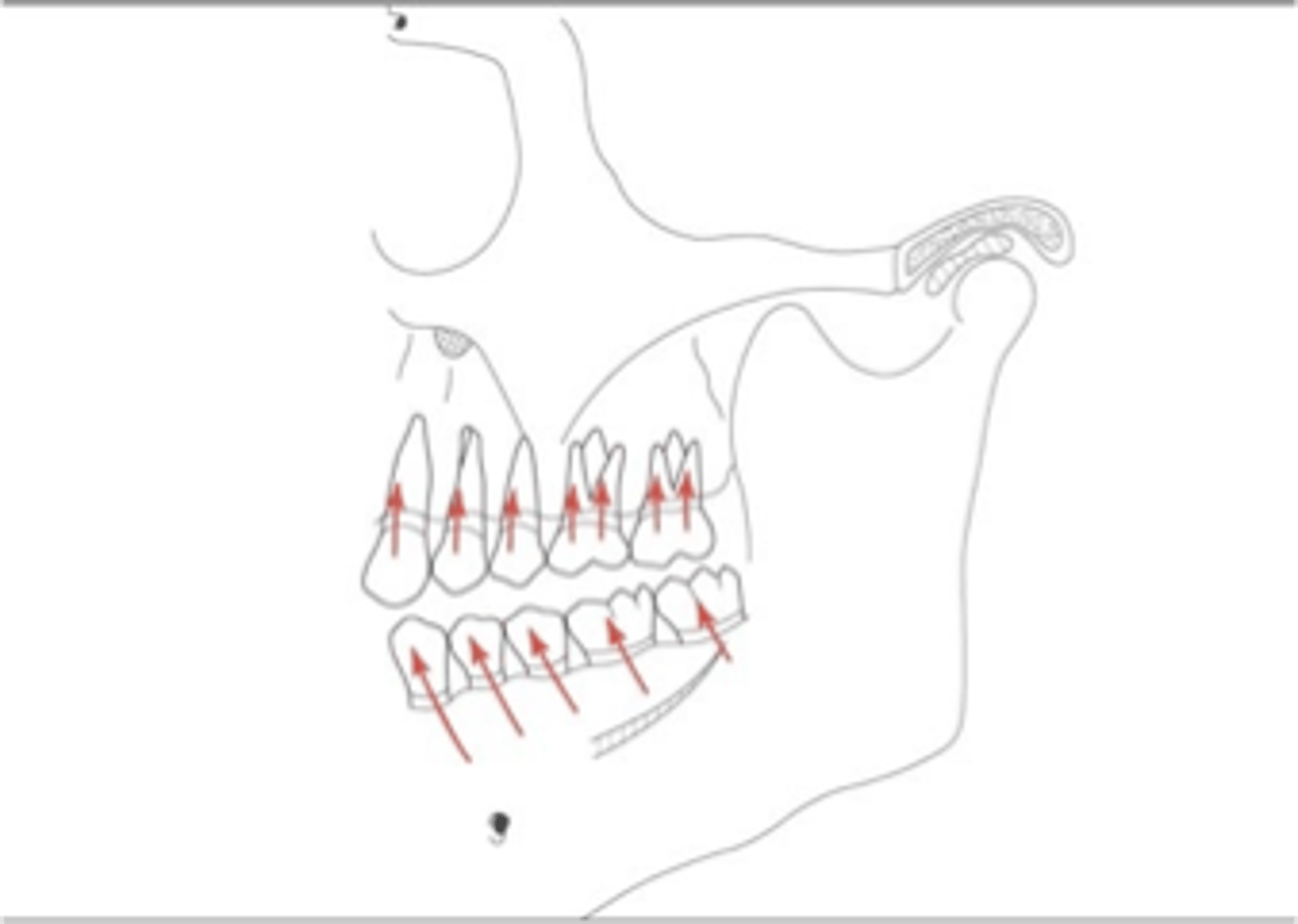 <p>In well-aligned, intact dental arches, teeth and periodontium sustain mostly ...</p>