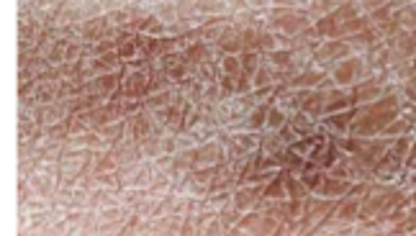 <p>Keratotic Disorders:</p><p>Overview:</p><p>- medical term for dry skin that’s more severe than typical</p><p>- Common, minor, and temporary problem, but may cause discomfort</p><p>- Skin may get dry, scaly, itchy, and red</p>