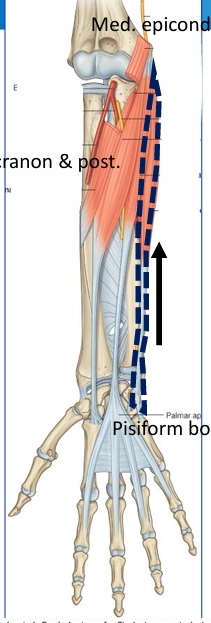 <p>Name this muscle</p>