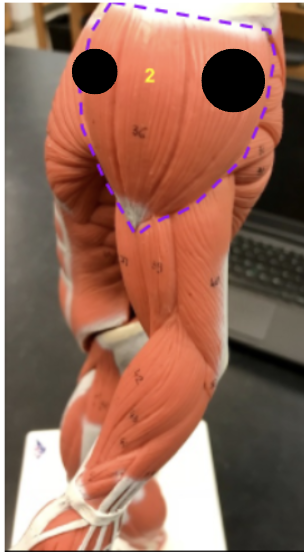 <p>What is #2 of the deltoid, the origin and the insertion?</p>