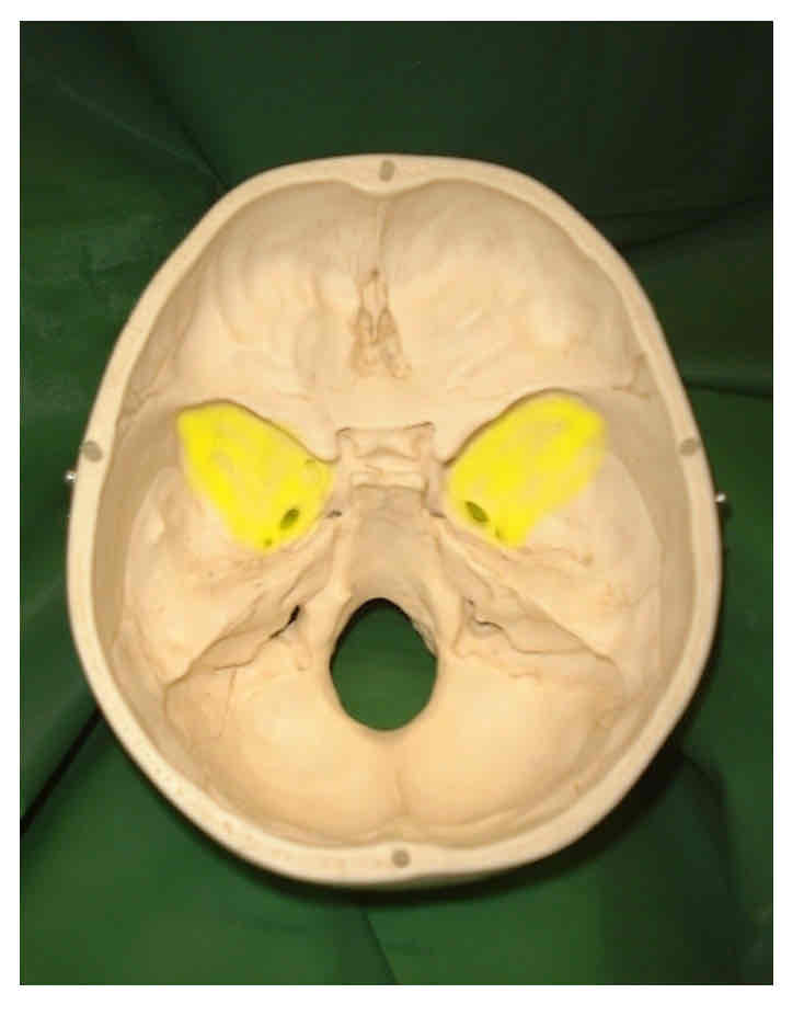term image