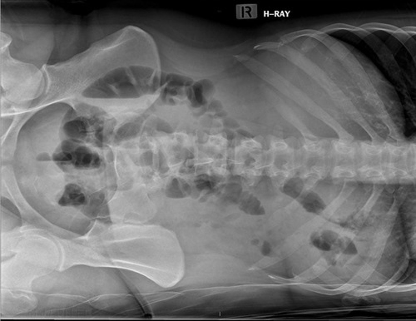 <p>What view is this image in?</p>