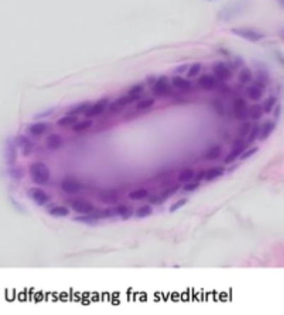 <p>Angiv epitheltypen</p>