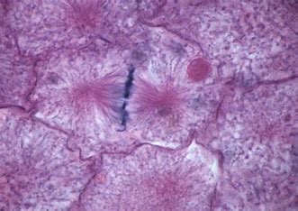 <ul><li><p>metaphase</p></li></ul>