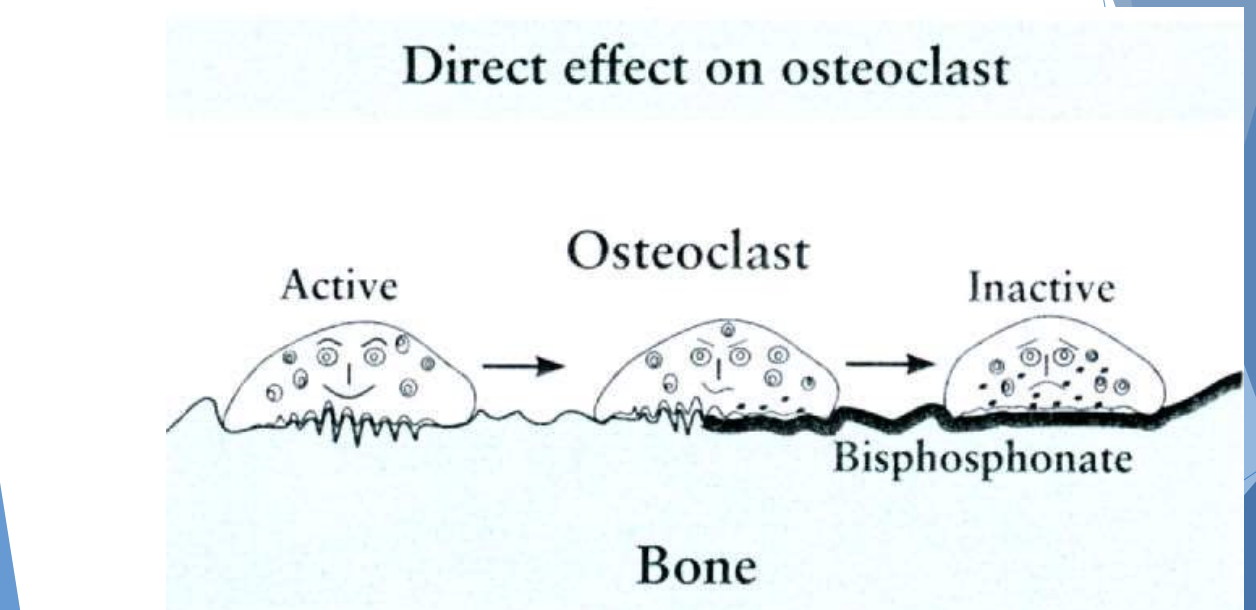 <ul><li><p>Bisphosphonates</p></li><li><p>Denosumab</p></li></ul><p></p>