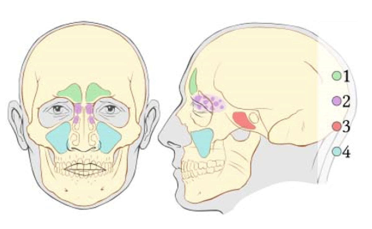 <p><strong>Identify the purple area, #2</strong><br>A. Frontal sinuses<br>B. Maxillary sinuses<br>C. Frontal sinuses<br>D. Ethmoid sinuses</p>