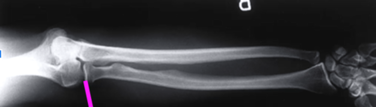 <p>what does this pink line point to?</p>