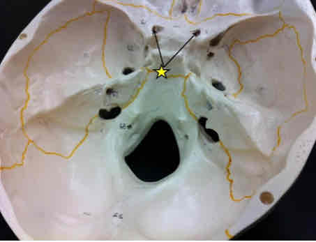 <p>What cranial nerve is indicated?</p>