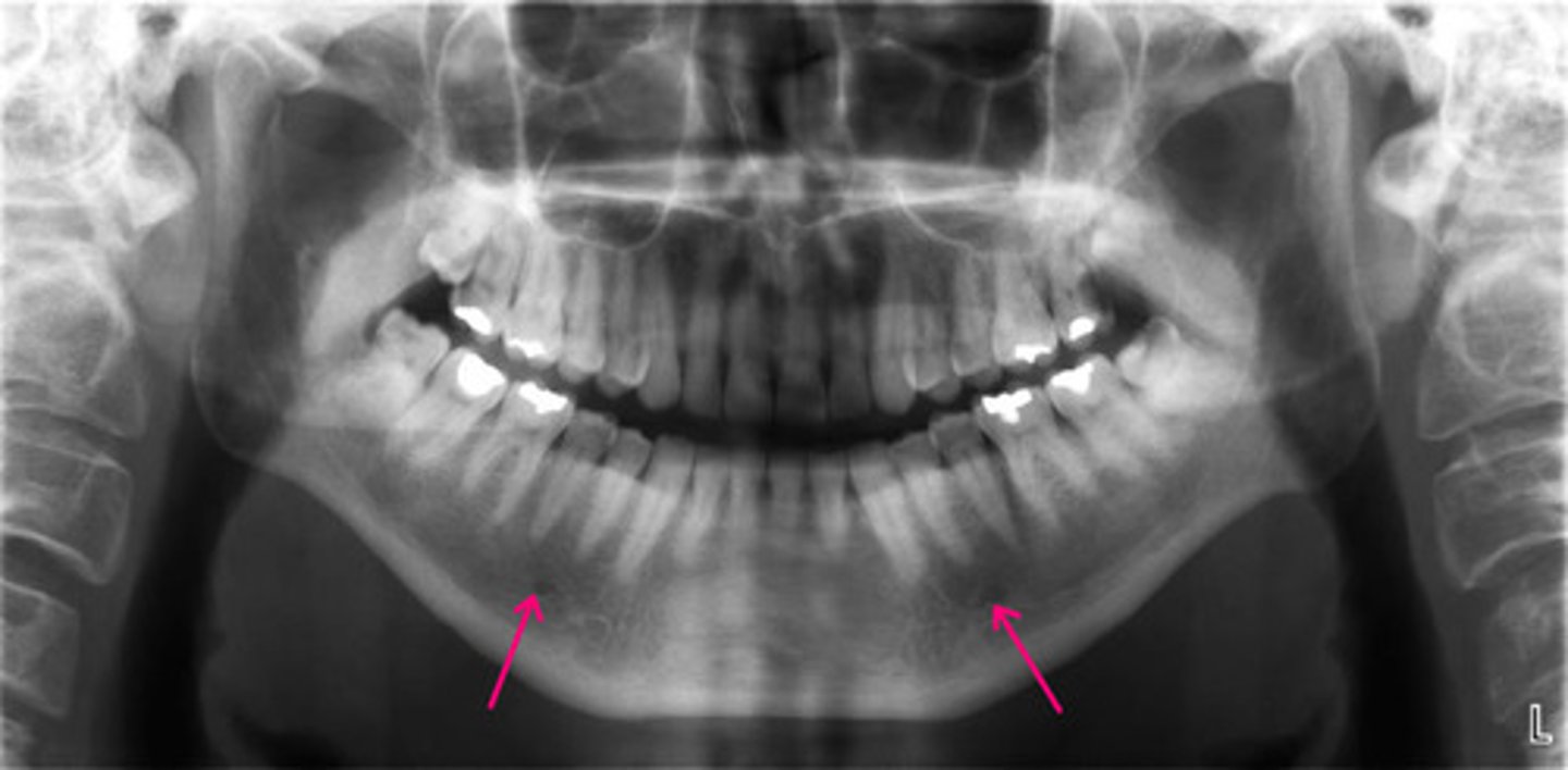 <p>Identify the structure.</p>